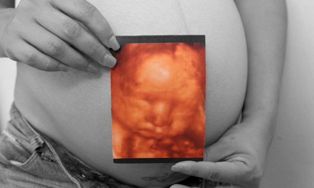 3d-4d-ultrazvuk-slika