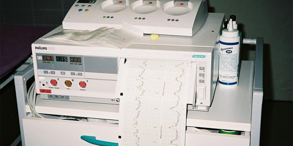 Kada treba da uradite CTG u trudnoći